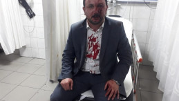 Bursa'da sendika başkanına darp!