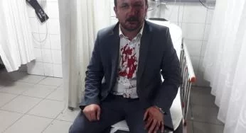 Bursa'da sendika başkanına darp!