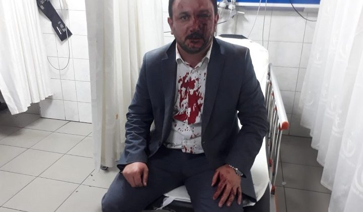 Bursa'da sendika başkanına darp!