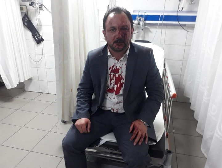Bursa'da sendika başkanına darp!