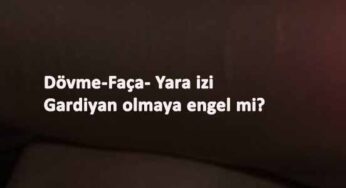 Gardiyan alımında dövme-yara izi-faça sorun olur mu? Elenme sebepleri nelerdir?