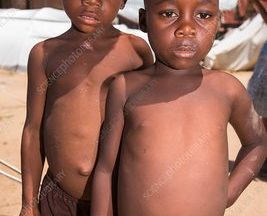 Bir Yanda Açlıktan Ölüm, Bir Yanda Diyet Kuyruğu